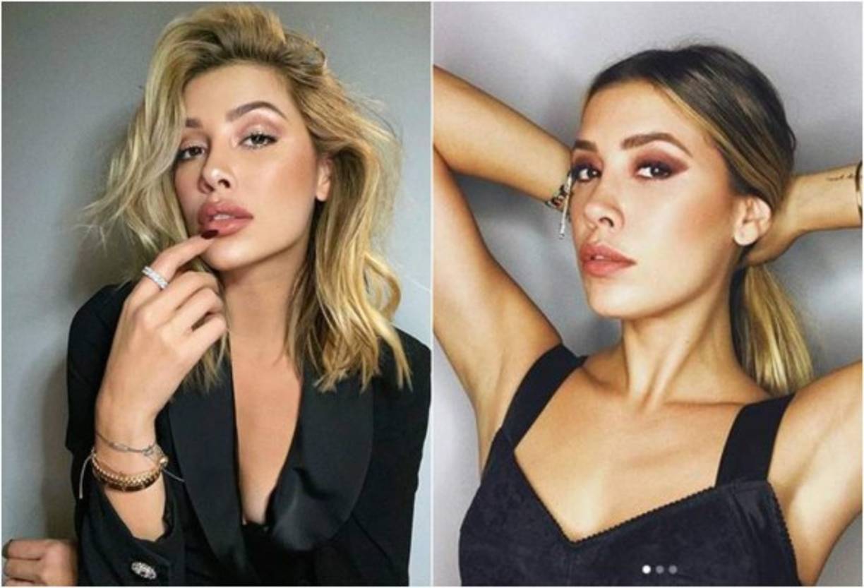 Uno de los cambios que más se ha notado en su rostro son sus labios, y en su última aparición dejó de ser una chica con una boca 'normal'.