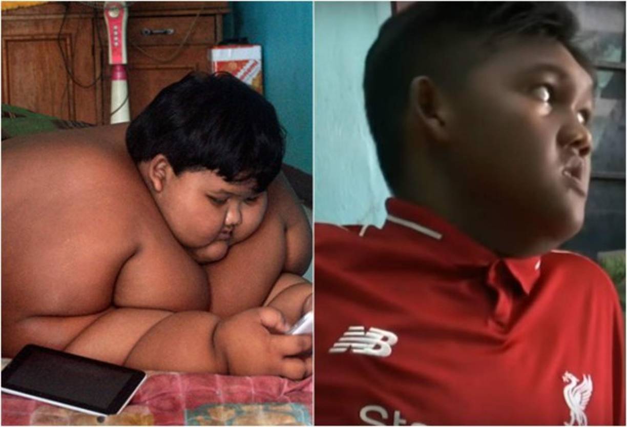 La vida cambió para el niño que vivía postrado.