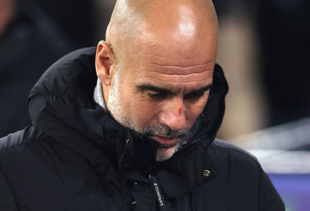 Pep Guardiola preocupó a todos por como apareció con rasguños en su rostro y cabeza tras el partido del Manchester City.
