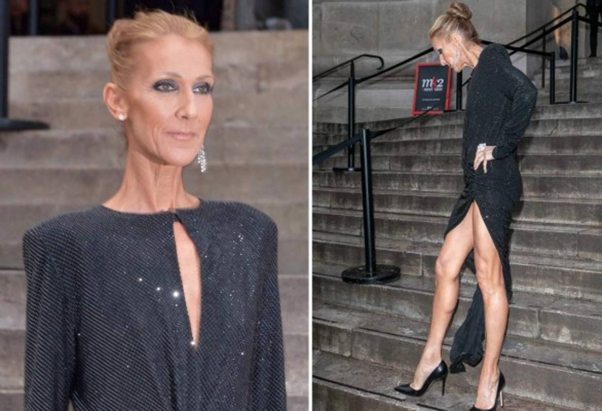 Pronto los medios se percataron de que la intérprete de 'My Heart Will Go On' y 'The Power of Love' lucía demasiado delgada y hasta mucho mayor a los 50 años que tiene.<br/>