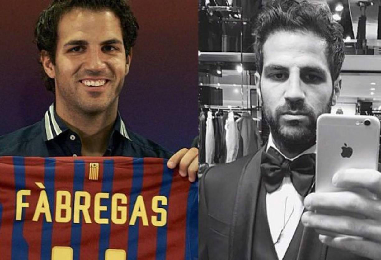 Cesc Fábregas se fracturó la nariz mientras disputaba un partido con el Chelsea. El catalán pasó por el quirófano y, aunque él no lo ha confirmado, se rumoreó que también había aprovechado para hacerse un pequeño retoque estético.