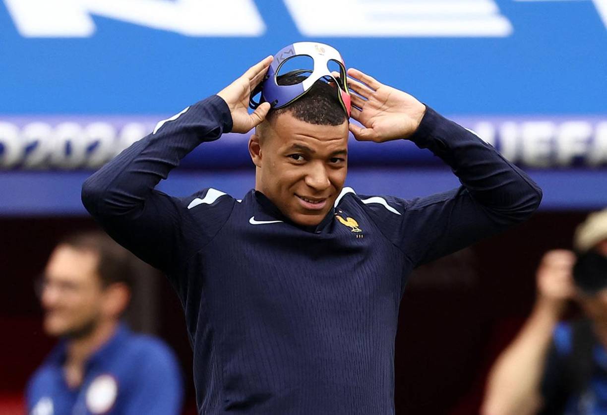 Kylian Mbappé dejó ver ante los medios de comunicación cómo quedó su nariz días después de la fractura que sufrió.