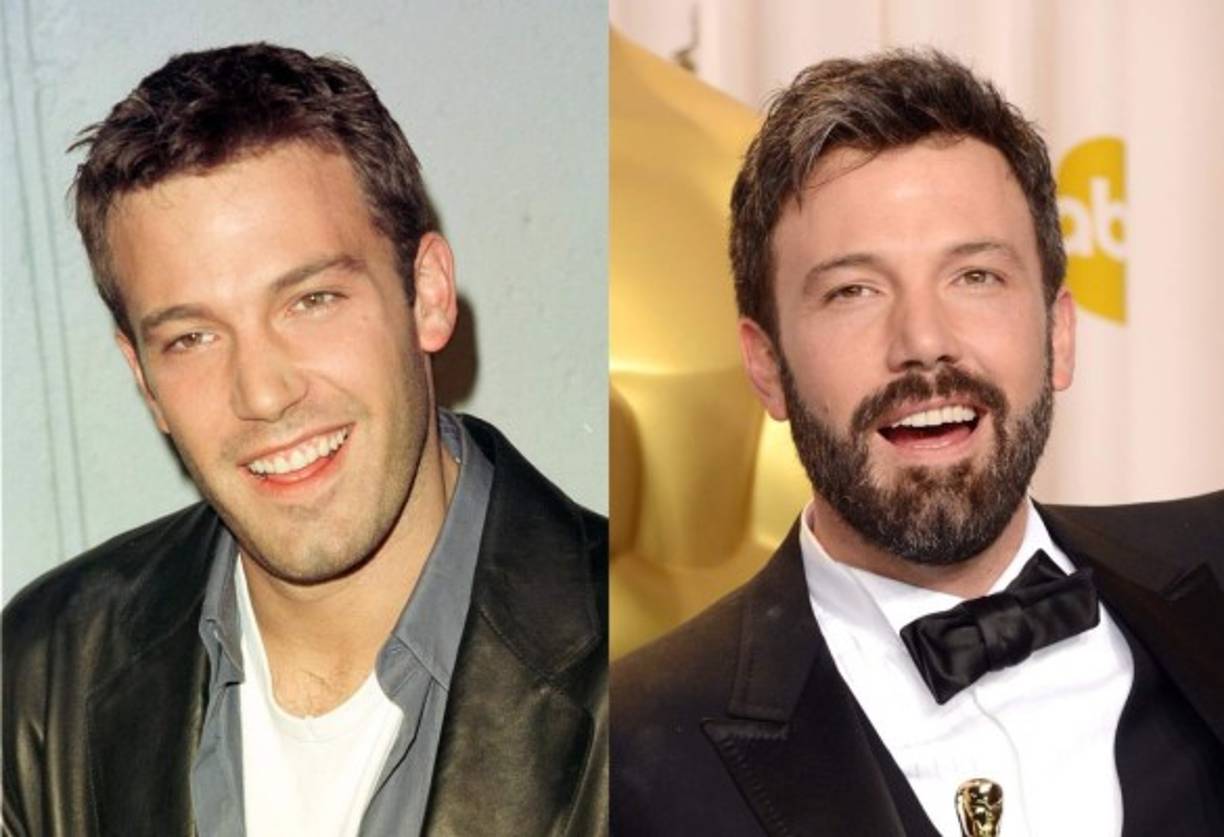 Algo que no le gustaba mucho y cambió gracias a una cirugía dental.