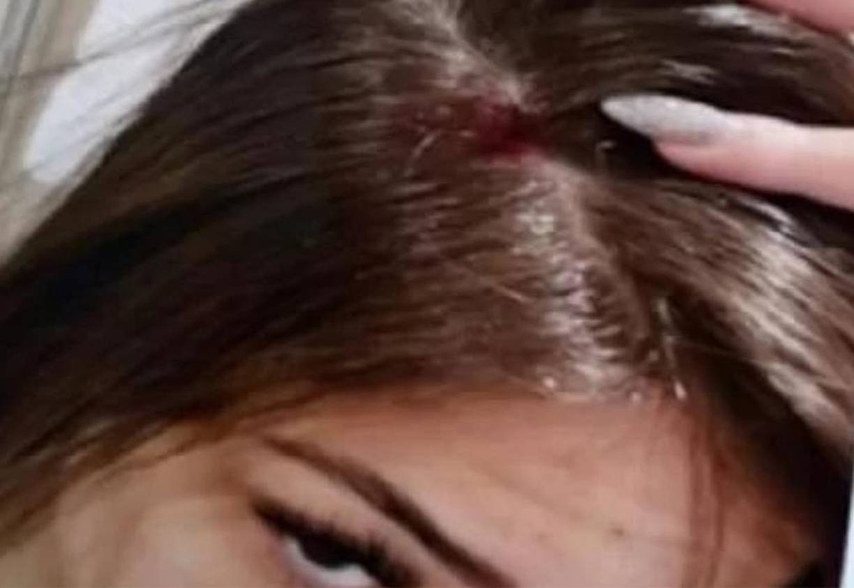 Brasil fue eliminado por Croacia el 9 de diciembre y el 15 de enero Gabriela volvió a ser agredida: acusó que el futbolista le propinó un cabezazo que le provocó un corte en la cabeza y que le desprendido la prótesis de silicona mamaria con un puñetazo en el pecho.