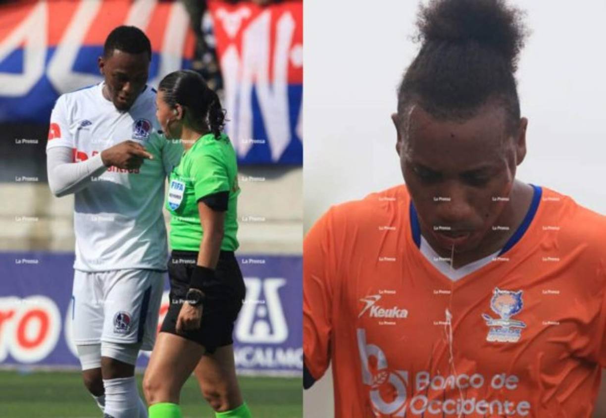 Mira las imágenes más curiosas de lo que fue la victoria de 1-3 del Olimpia ante la UPN por la ida de semifinales. La árbitro Melissa Pastrana tuvo una difícil tarde y jugador de Los Lobos fue trasladado de emergencia a un Hospital.