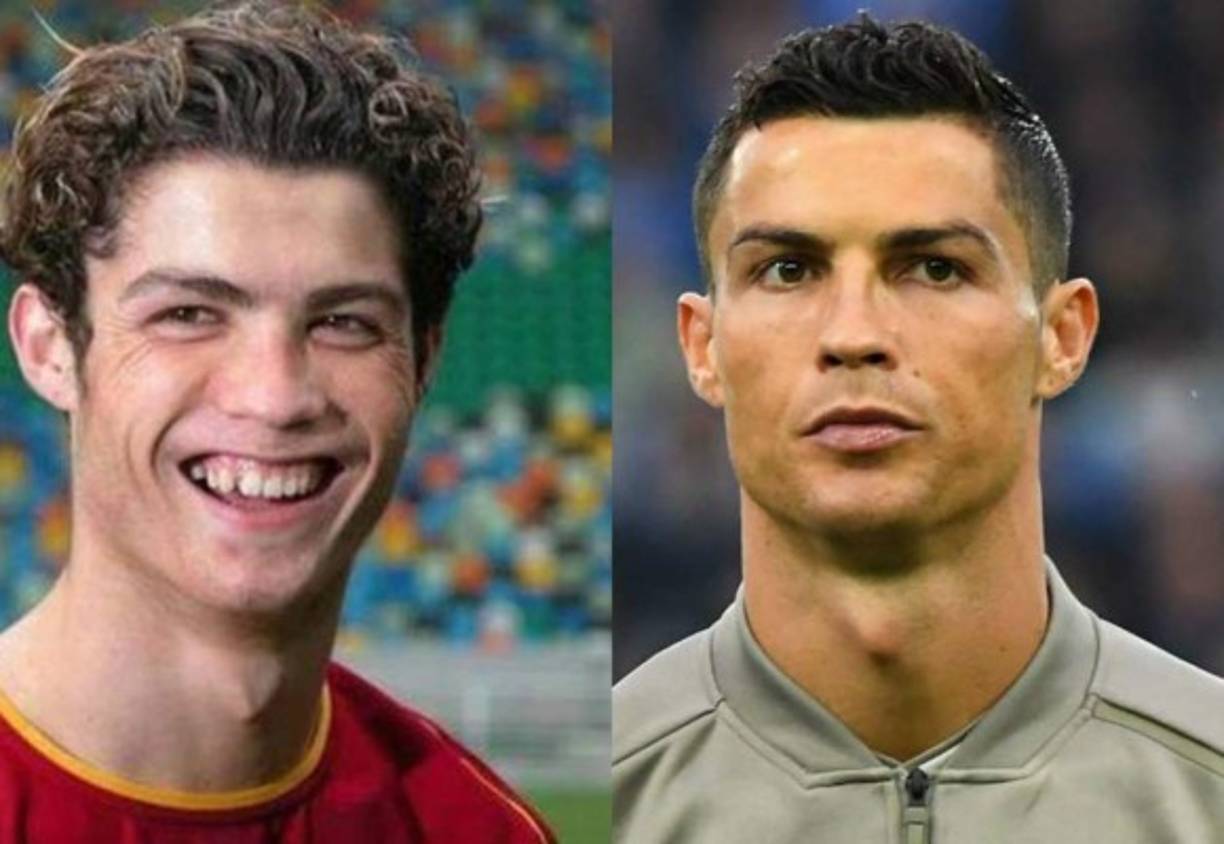 El astro portugués Cristiano Ronaldo es uno de los deportistas mejores pagados en el mundo y en esta ocasión ha causado revuelo luego de que se ha filtrado las cirugías plásticas que se habría hecho para mejorar su aspecto.