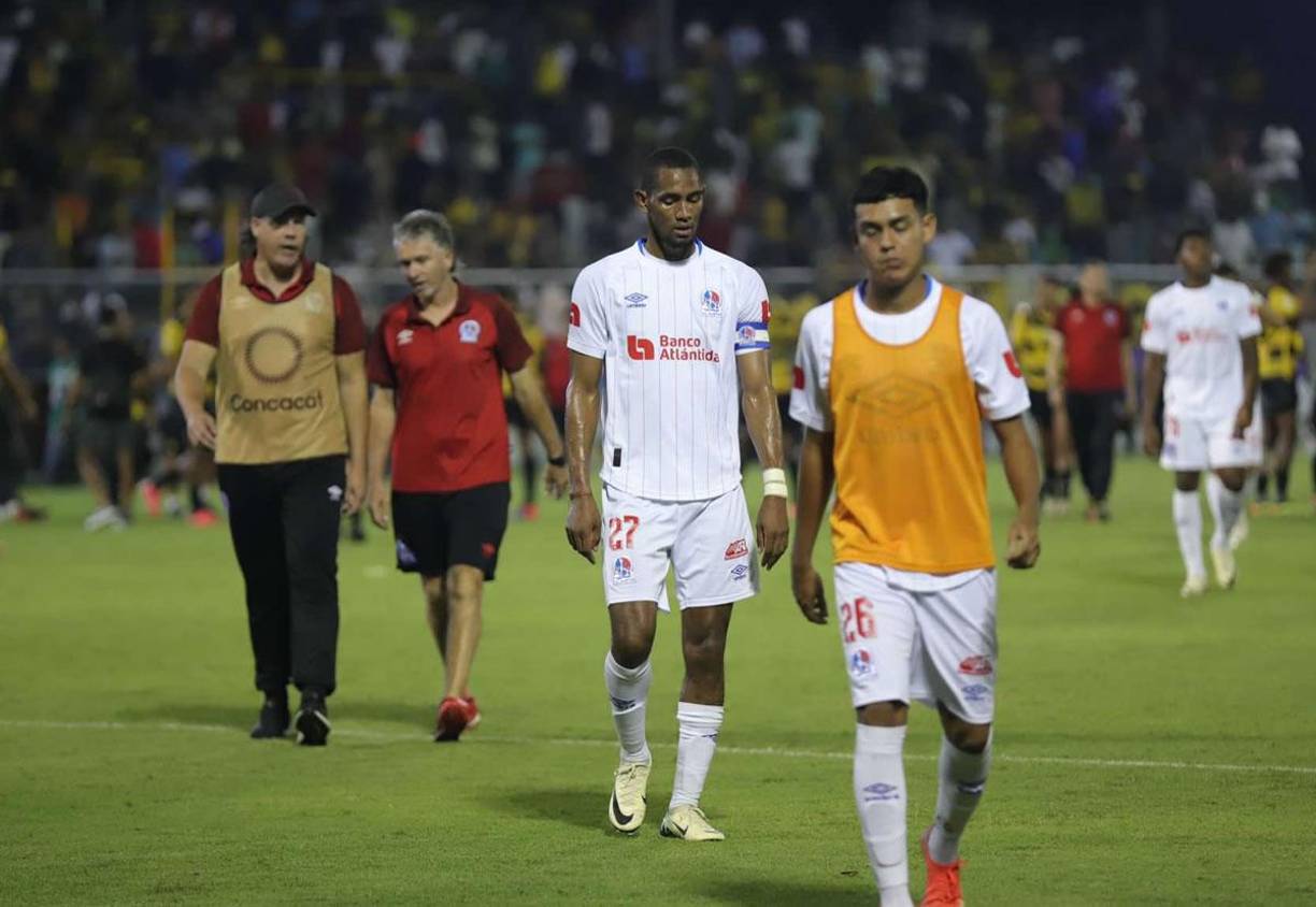 Las caras largas de los integrantes del Olimpia por la tercera derrota del Torneo Apertura 2024.