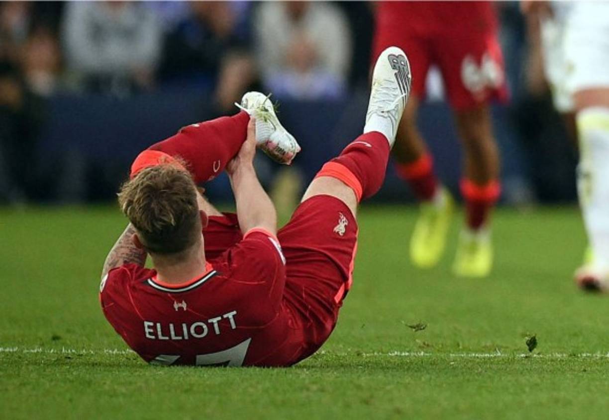 Así le quedó el tobillo izquierdo a Harvey Elliott tras la acción con Pascal Strujik.