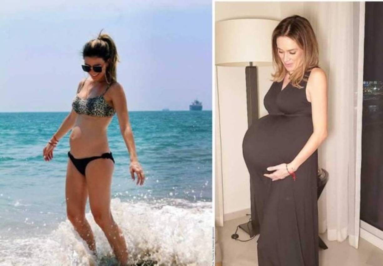 “Tenía una hernia en el ombligo, entonces me quito la hernia, me cosió los músculos del abdomen porque los tenía totalmente separados.”, agregó.