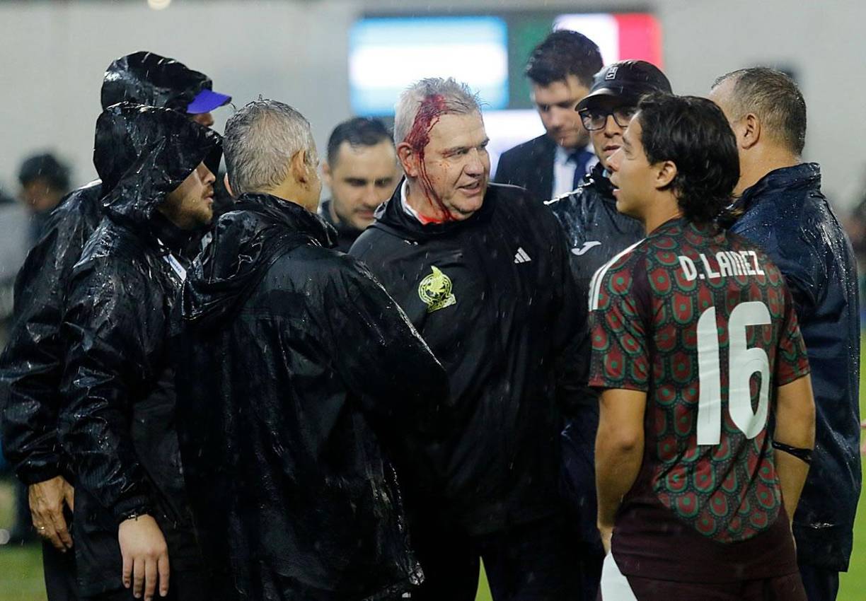 El entrenador mexicano se fue bañado de sangre del campo y recibó cuatro puntos de sutura.