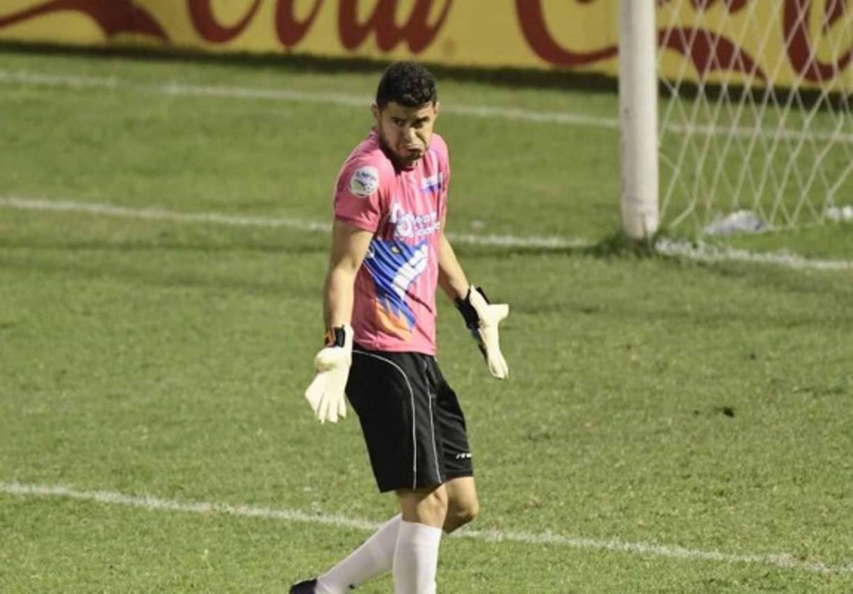 Celio Valladares: El portero se quedó sin contrato en la UPN y espera arreglar con Los Lobos para seguir en el equipo.