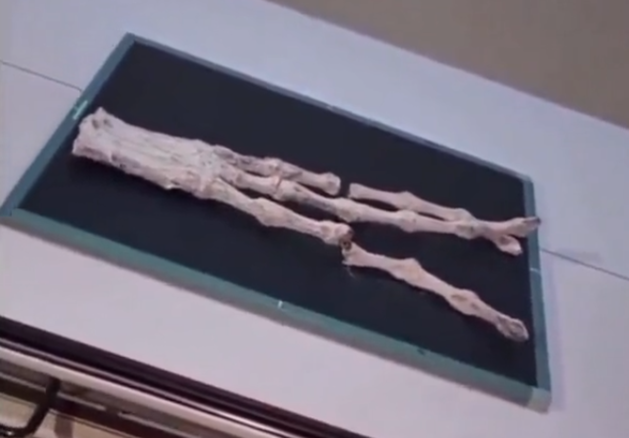 Después de la exposición de una decena de especialistas en la materia, comenzó el insólito suceso que ha dado la vuelta al mundo: la apertura de dos cajas con presuntos cadáveres de alienígenas, presentados como “momias alienígenas de Nazca”.