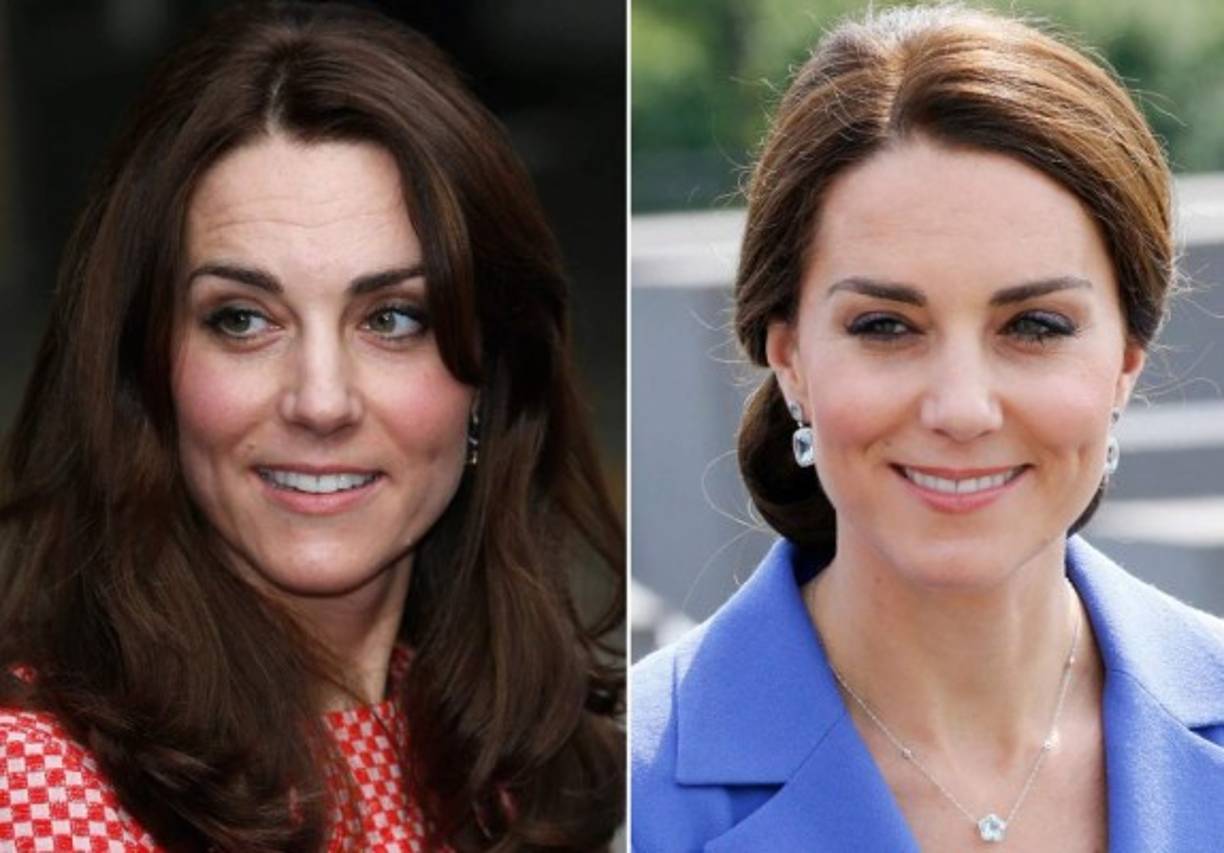 Kate Middleton usa botox<br/><br/>La duquesa de Cambdrige, esposa del príncipe William fue señalada de usar botox después que una clínica estética la usara para promover dicho tratamiento. El palacio negó los rumores y amenazó con tomar acciones legales contra los que usaran la imagen de la royal para estos fines. <a href='https://www.laprensa.hn/fotogalerias/farandula/1305534-411/fotos-kate-middleton-usar-botox-antes-despues-cara-arrugas' style='color:red;text-decoration:underline' target='_blank'>El antes y después de Kate Middleton tras presunto tratamiento con botox</a><br/><br/>Meghan Markle sufrió algo similar cuando su imagen fue usada para promocionar unas pastillas para adelgazar. Una marca llegó a falsificar los testimonios de la duquesa de Sussex para promocionar su producto hasta que la Casa Real amenazó con demandarlos.<br/>