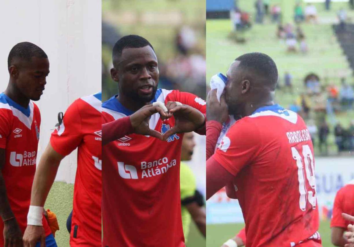 Las imágenes del triunfo del Olimpia ante Juticalpa con Yustin Arboleda como figura. Fue el triunfo más triste en el cuadro olimpista debido a la muerte de su futbolista Demetri Gordon. 