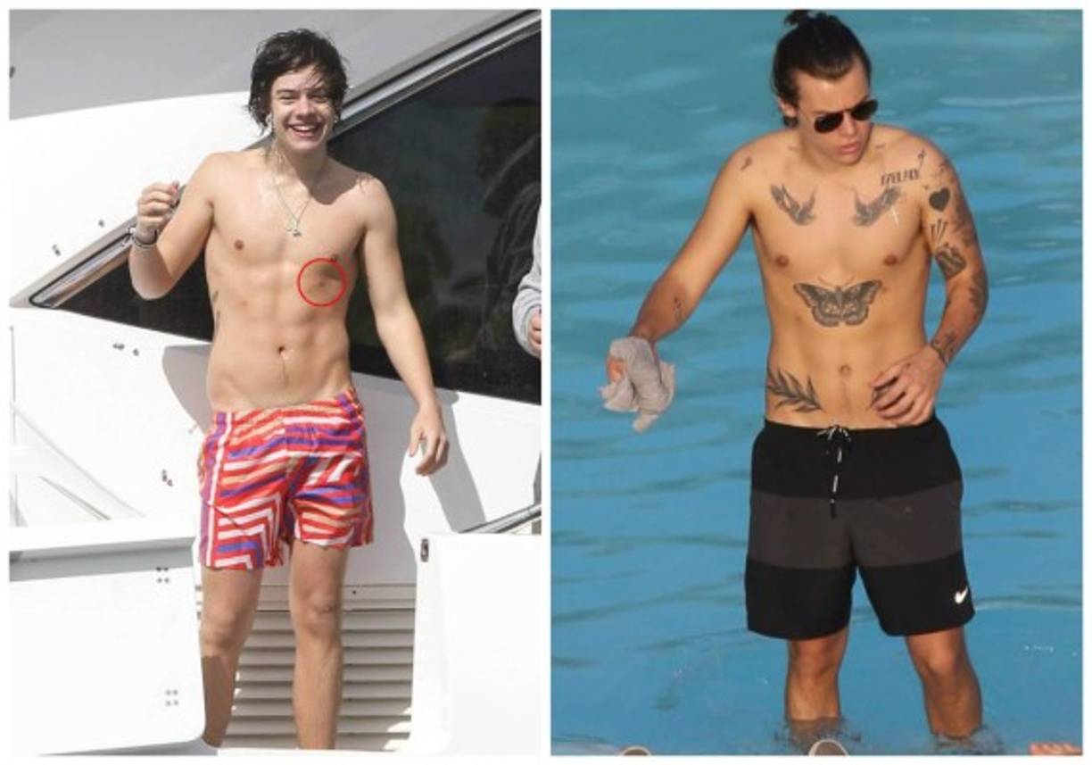 Harry Styles tiene dos pezones extra que se podían apreciar perfectamente antes de pasar tantas veces por el estudio del tatuador aunque realmente nunca ha intentado camuflarlos.<br/>