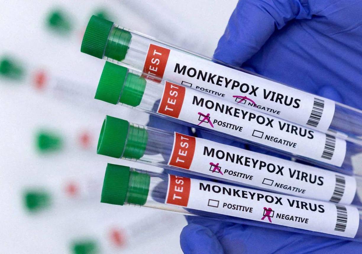 En noviembre de 2022, la OMS anunció su preferencia por el término “mpox”, una abreviatura del nombre original en inglés “monkeypox”, como sinónimo de la enfermedad conocida como viruela del mono.