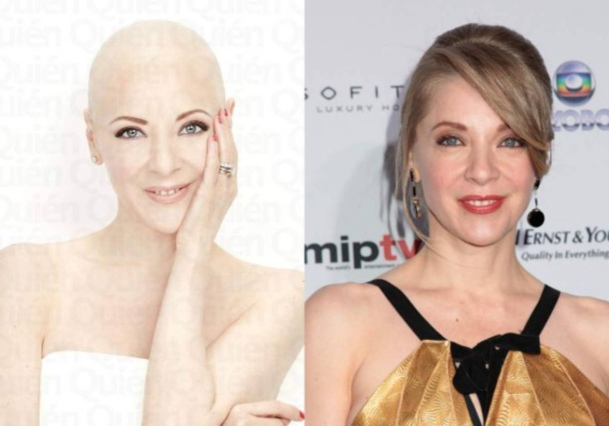 Edith González - Junio 13 de 2019<br/>Edad: 54 años<br/>Causa de muerte: Cáncer de ovarios<br/><br/>La actriz mexicana falleció después de varios año de lucha contra aun cáncer de ovarios detectado a finales de 2016. González había entrado en remisión, sin embargo, su salud volvió a tener un revés que terminó por provocar su muerte.<br/><br/><a href='https://www.laprensa.hn/fotogalerias/farandula/1293044-411/edith-gonzalez-telenovelas-mas-famosas-personajes-iconicos' style='color:red;text-decoration:underline' target='_blank'>A la estrella de novelas como </a> 'Doña Bárbara' o 'Salomé' le sobreviven su hija Constanza Creel y su viudo, Lorenzo Lazo.<br/><br/>