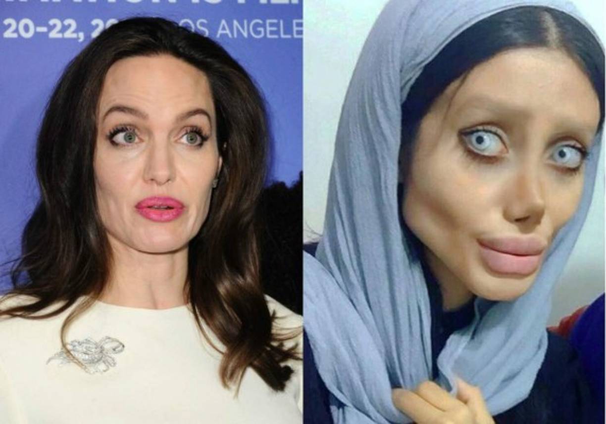 Una mujer de Irán se ha vuelto viral después de afirmar que ha tenido 50 cirugías en un intento por parecerse a su ídolo Angelina Jolie.<br/>