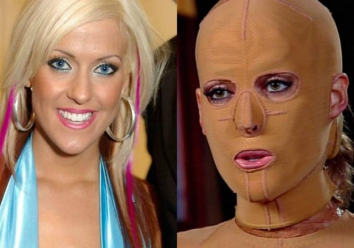 Tras vivir un infierno en carne propia, la modelo australina Dana Vulin (31) reapareció para enseñar las marcas que quedaron en su cuerpo y envíar un mensaje de esperanza a las víctimas de este tipo de ataques.<br/>