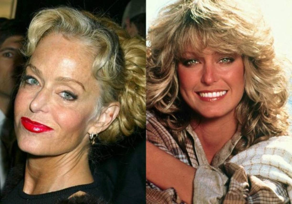 Farrah Fawcett<br/><br/>A la actriz le diagnosticaron cáncer de ano en 2006, el cual hizo metástasis en su hígado, por lo que perdió la batalla contra dicha enfermedad en junio de 2009, a los 62 años.