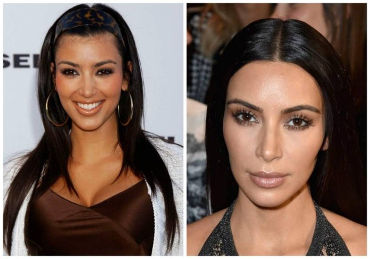 Nadie mejor que Kim Kardashian para cerrar esta lista. Lo que hacen 10 años de fama y fortuna.