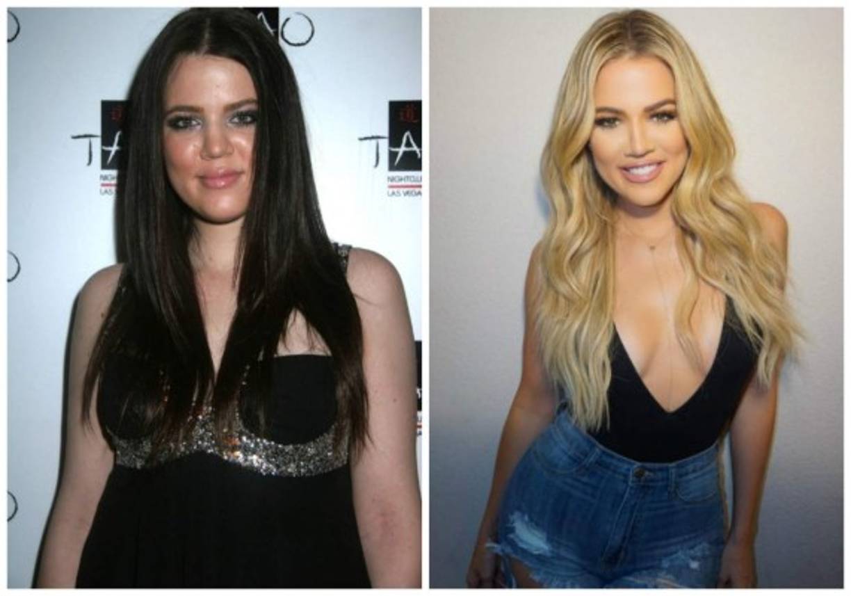 La celebridad Khloé Kardashian ha cambiado mucho su aspecto físico, aunque ella asegura que ha sido solo una buena dieta y mucho ejercicio, en comparación con su versión más joven parece otra.