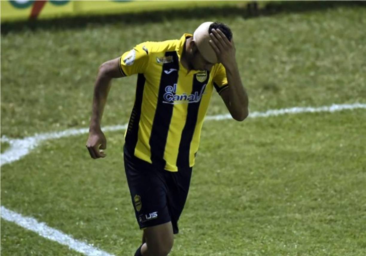 Getsel Montes terminó jugando el clásico con un vendaje en su cabeza.
