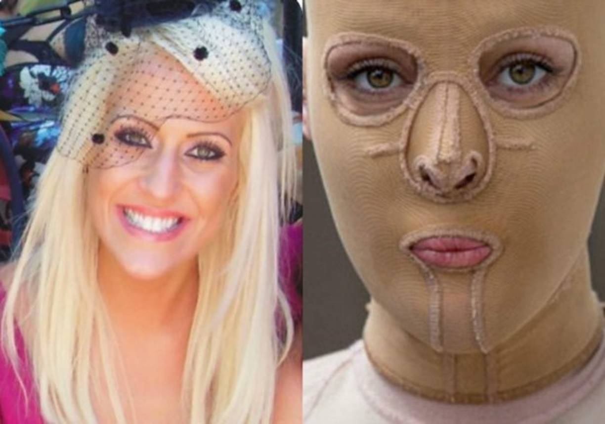 En 2012 la rubia sufrió un ataque por parte de una 'supuesta' amiga, llamada Natalie Dimitrovska. En ese entonces Dana tenía 25 años.