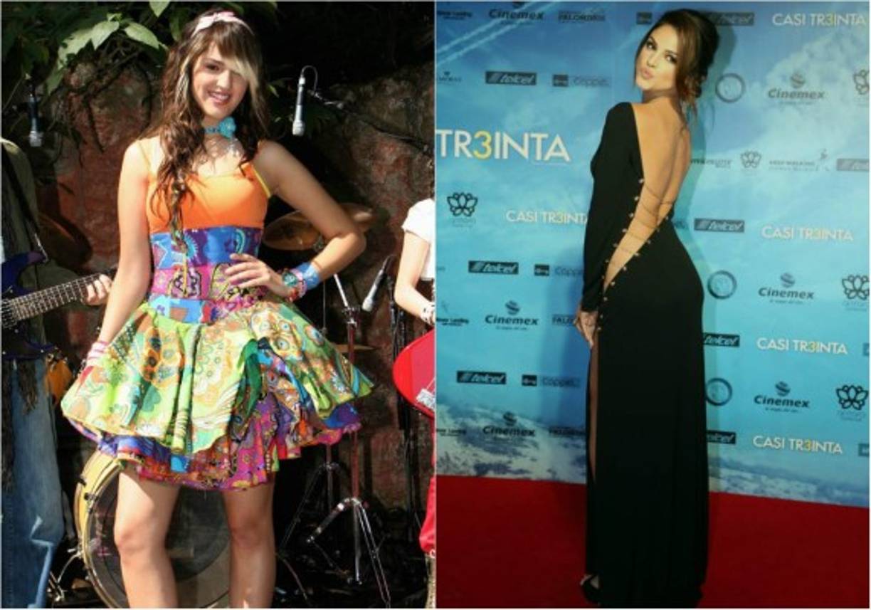 Medios mexicanos afirman que también se sometió a una reducción de pómulos, una de las operaciones más populares de las celebridades. Y es que su rostro redondo ahora se ve mucho más afilado con pómulos más marcados.