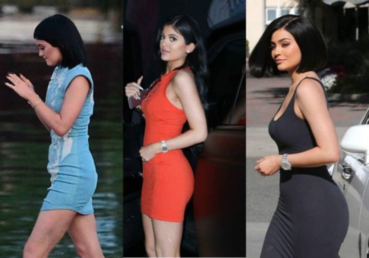 Además del retoque de caderas, aumento de busto y aumento de glúteos.