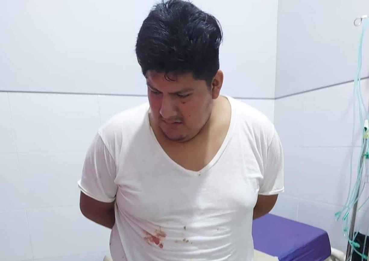 El agresor también fue trasladado al hospital Caranavi ya que se hirió el muslo por los ataques provocados. Posteriormente, fue arrestado por los policías y trasladado a la EPI, donde confesó que realizó el crimen porque la víctima había destruido su vida.