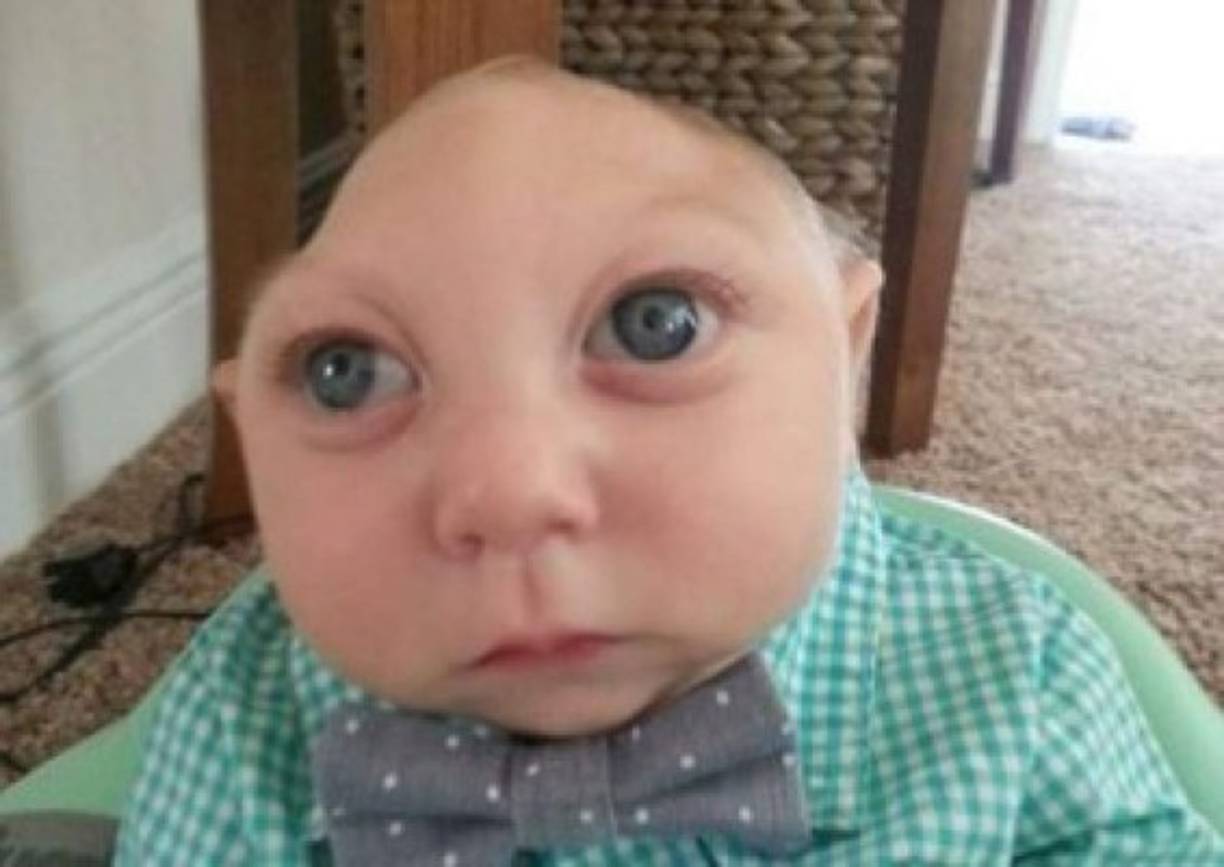 El bebé sobrevivió el embarazo y pesó cuatro libras en la unidad de cesárea el 27 de agosto de 2014, fecha en que nació.