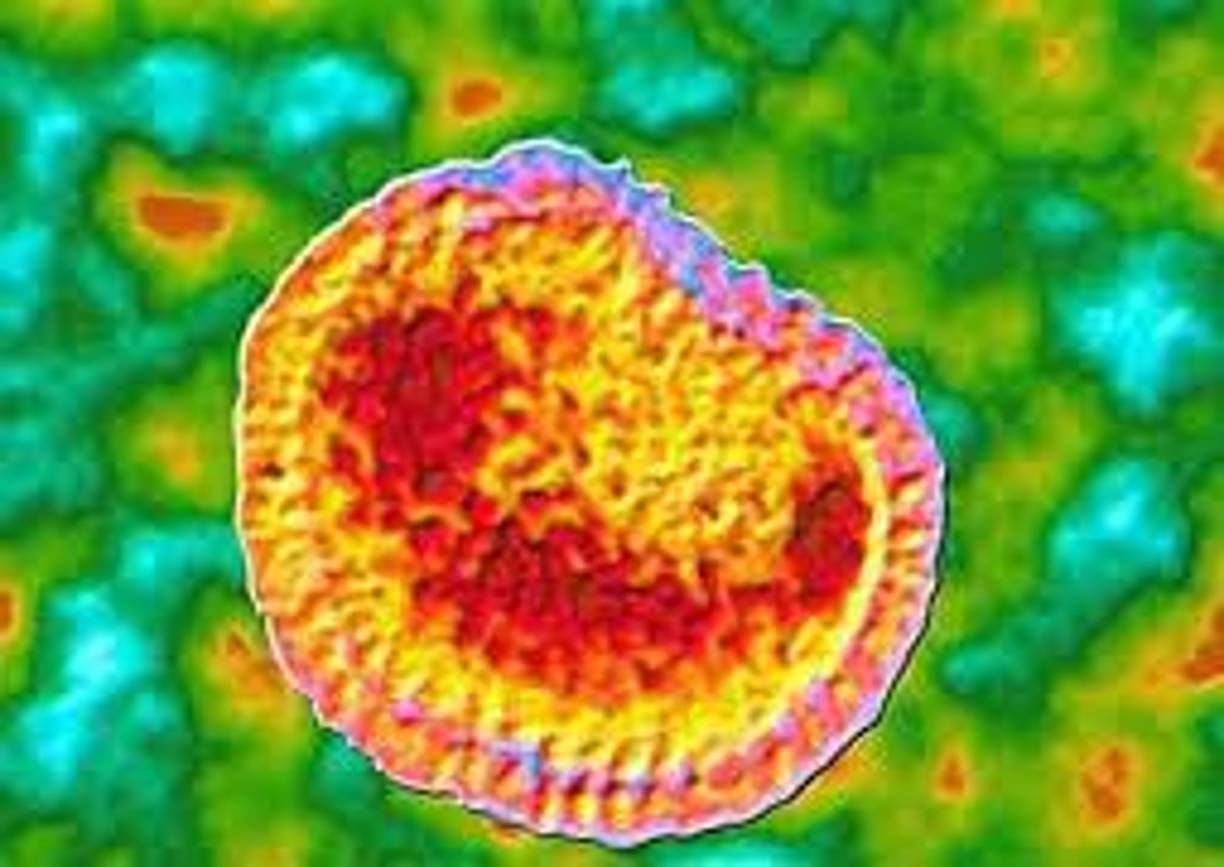 El primer caso de gripe aviar H5N1 en humanos en el continente americano se detectó en 2014 en Canadá. Se trató de un caso “importado” que ocurrió en un viajero que había regresado de China hacía muy poco, desde ese entonces no ha habido más reportes sobre infecciones humanas por la enfermedad. 