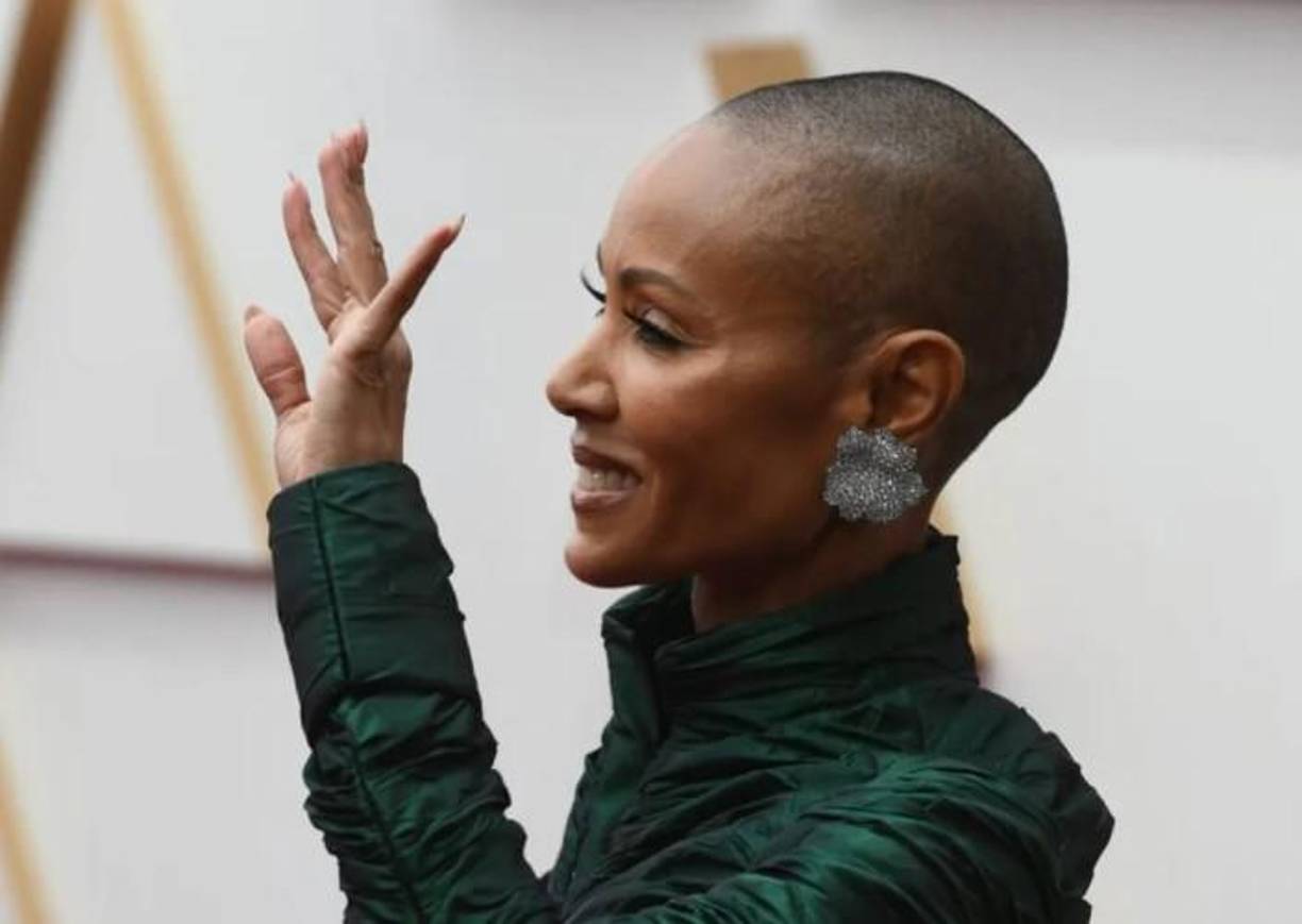 Este trastorno tiene un origen multifactorial, en especial una predisposición genética que provoca una alteración autoinmune. “Esa alteración hace que el organismo active el sistema de defensa contra el folículo piloso como si fuera un invasor externo y desarrolle anticuerpos contra ese folículo dando lugar a su pérdida”, indica el especialista.