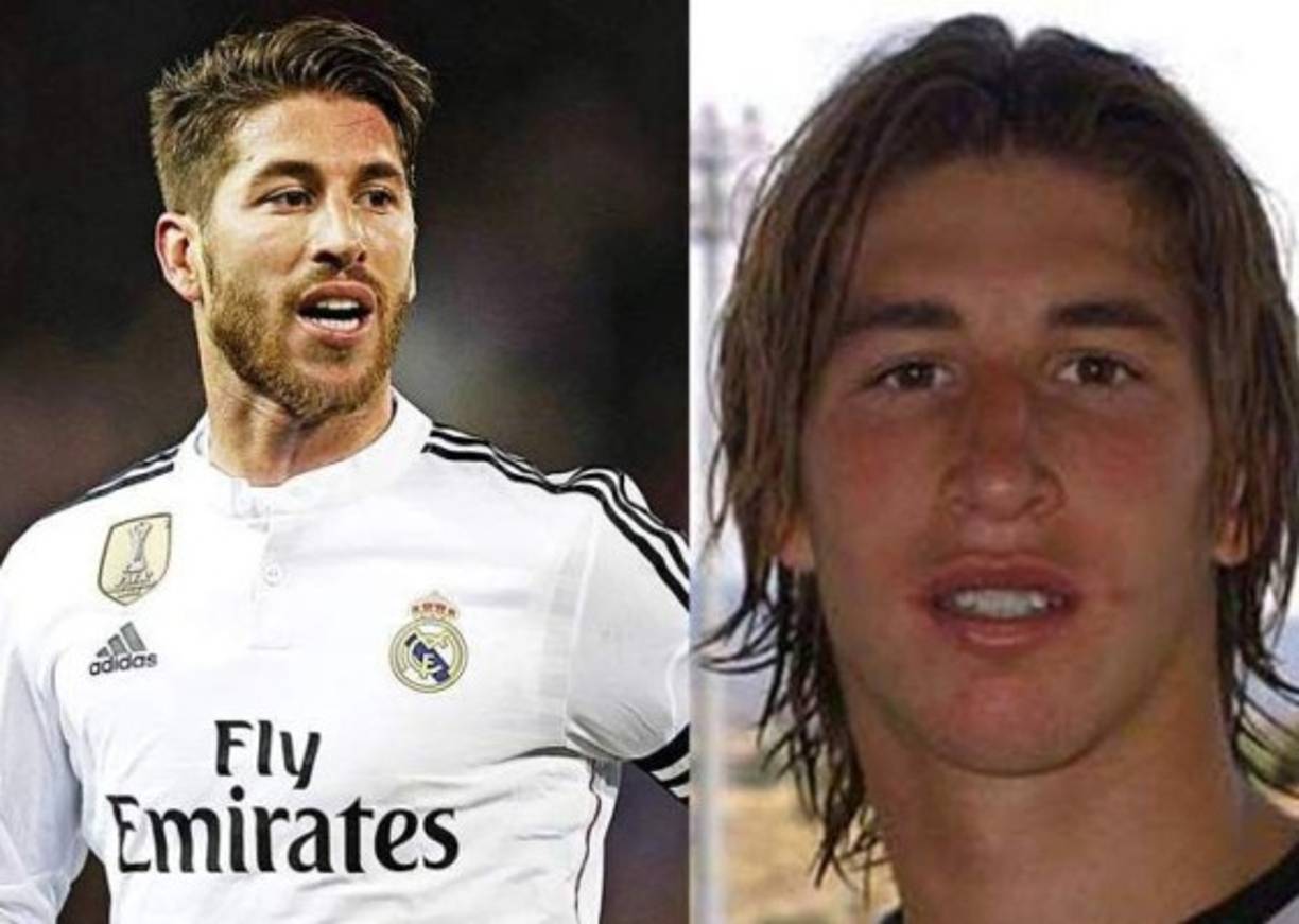 Sergio Ramos: El defensa se hizo una rinoplastia en 2007, aprovechando que se había fracturado la nariz.