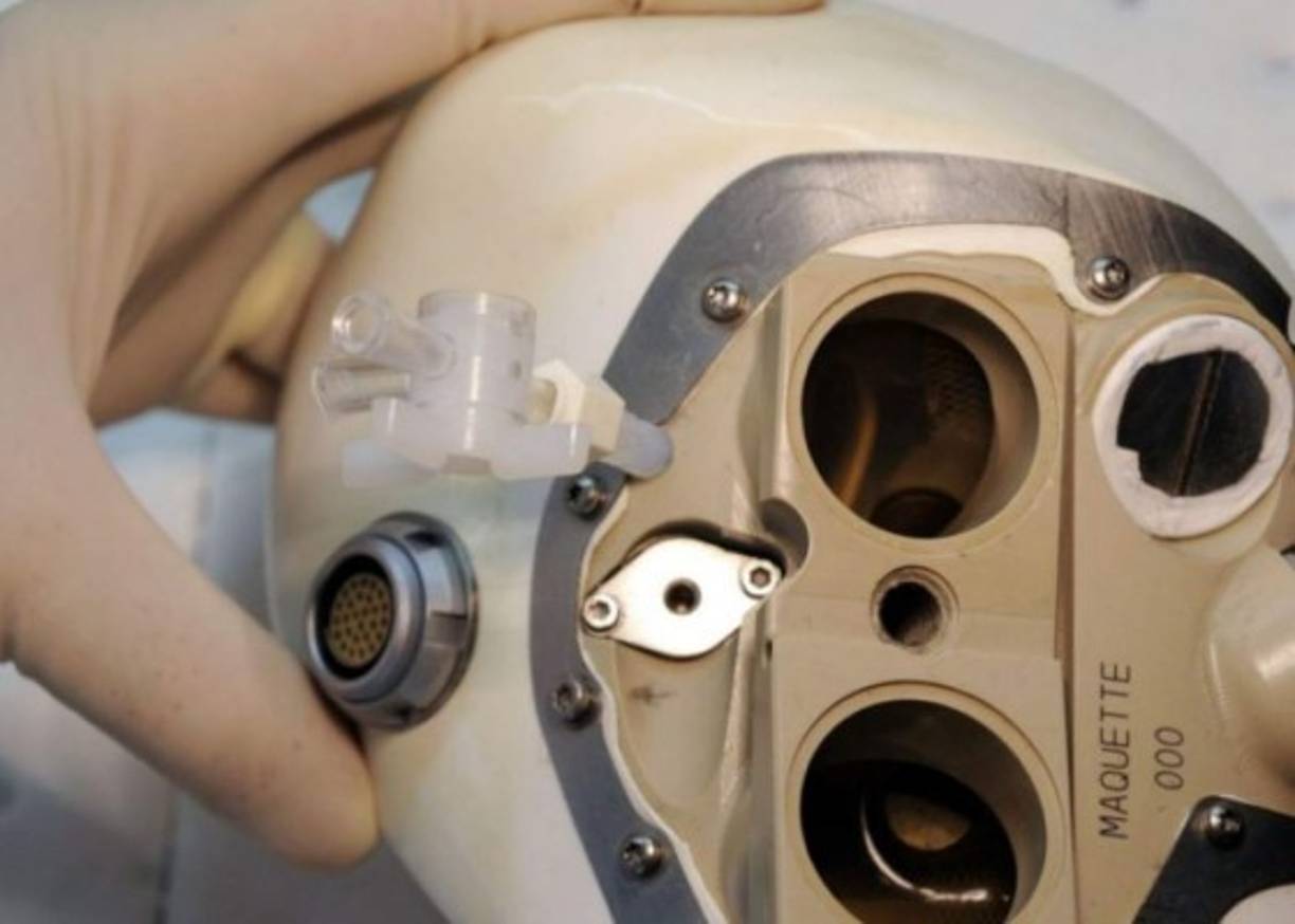 En la actualidad, la tecnología de TAH es utilizada solamente como un puente mientras el paciente espera un trasplante. El corazón artificial de Carmat fue aprobado por el momento como implante temporal.