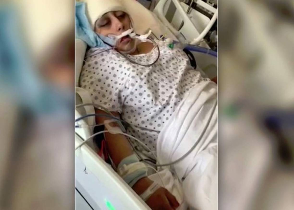 Una de sus hermanas, Jenny Saquipulla, dijo a Daily News que Ayda está estable. 'Puede mover su mano. Ha tenido cuatro cirugías y un tubo en su cráneo para drenaje', explicó.