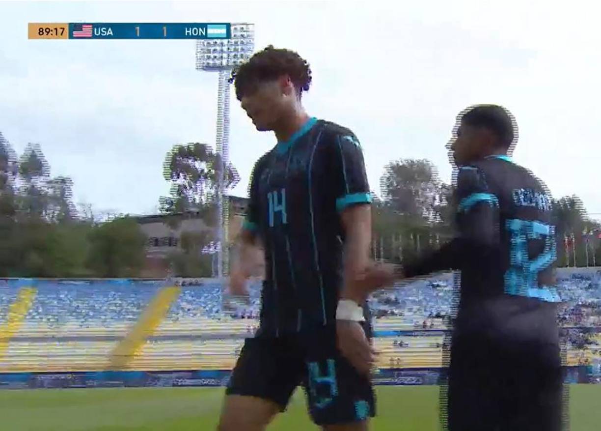 David Ruiz fue reemplazado por Samuel Elvir y se pudo escuchar en la transmisión que le dio mensaje de ánimo a su compañero que lo reemplazaba. 