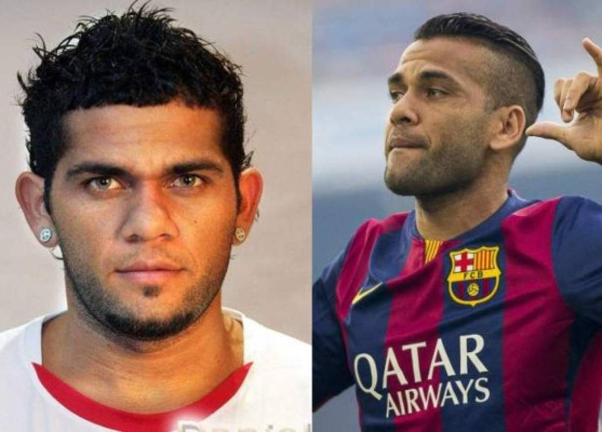 Dani Alves: El brasileño se sometió a una cirugía para reducirse las orejas; aunque el retoque paso casi desapercibido
