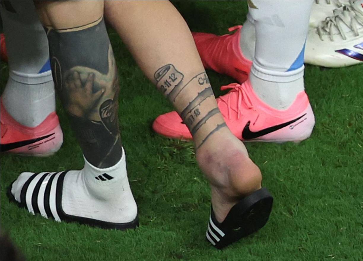 El tobillo derecho de Messi totalmente inflamado.