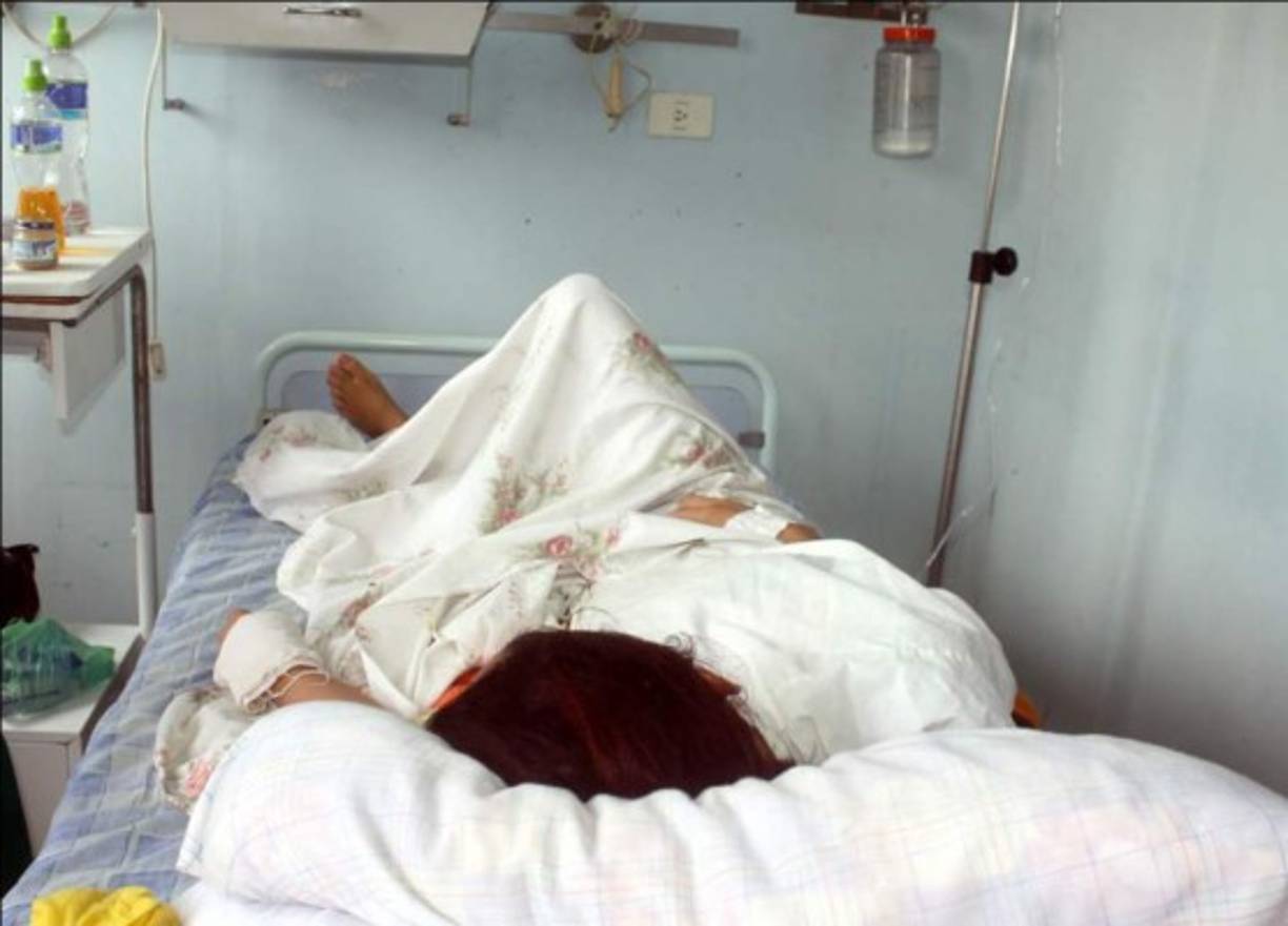 GRADO II<br/><br/>Todas las manifestaciones del grado I más<br/>- Hemorragia espontánea<br/><br/>GRADO III<br/><br/>- Hipotensión<br/>- Pulso rápido y débil<br/>- Piel fría y húmeda<br/>- Agitación<br/><br/>GRADO IV<br/><br/>- Todos los anteriores más: Hipotensión con pulso rápido y débil, piel fría pálida e <br/>irritabilidad del paciente.