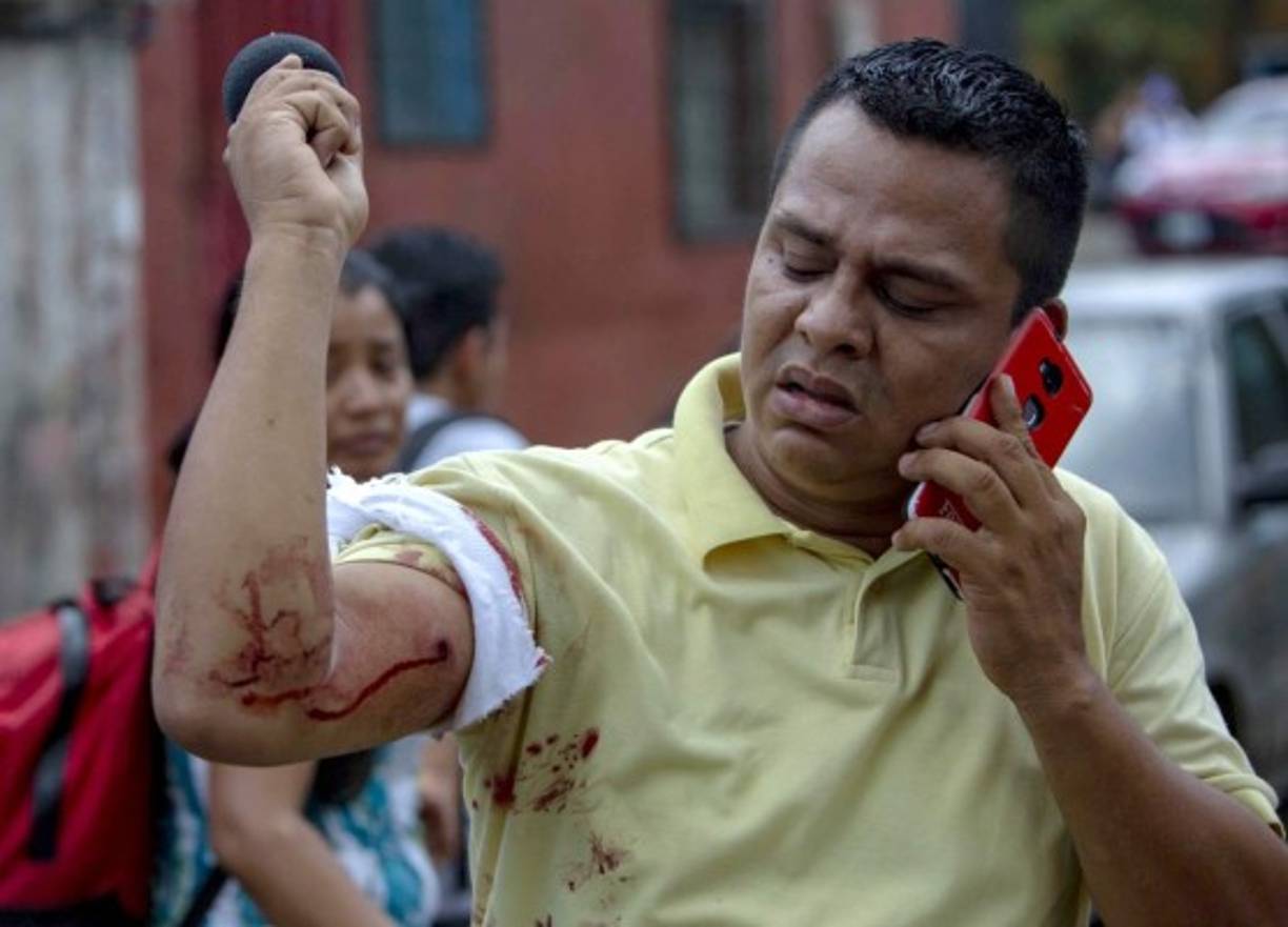 Entre los heridos se encuentra el periodista Wiston Potosme que cubría la marcha.