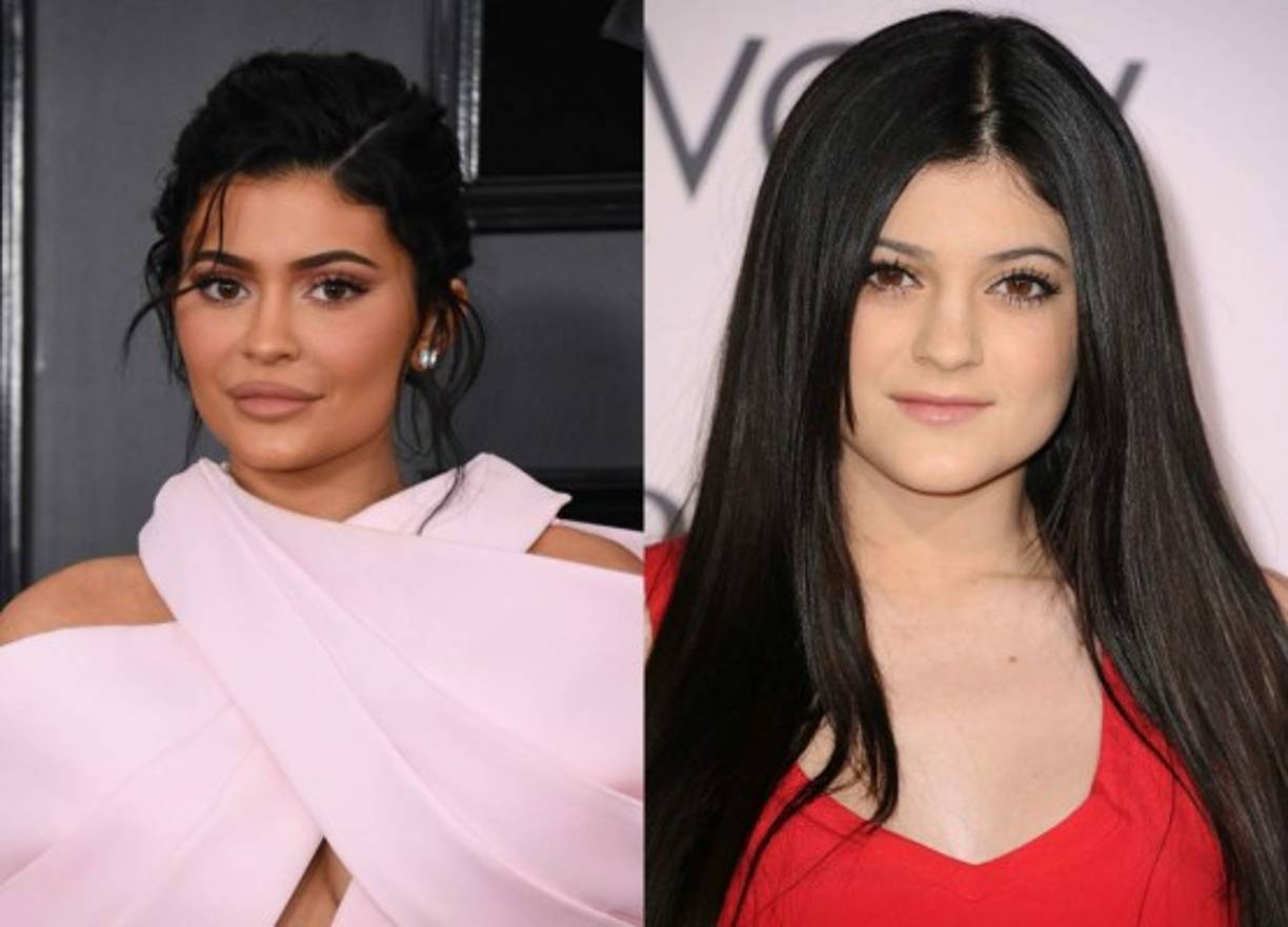 Los labios de Kylie Jenner han ido evolucionando con los años, bueno, además de prácticamente toda su anatomía.<br/>