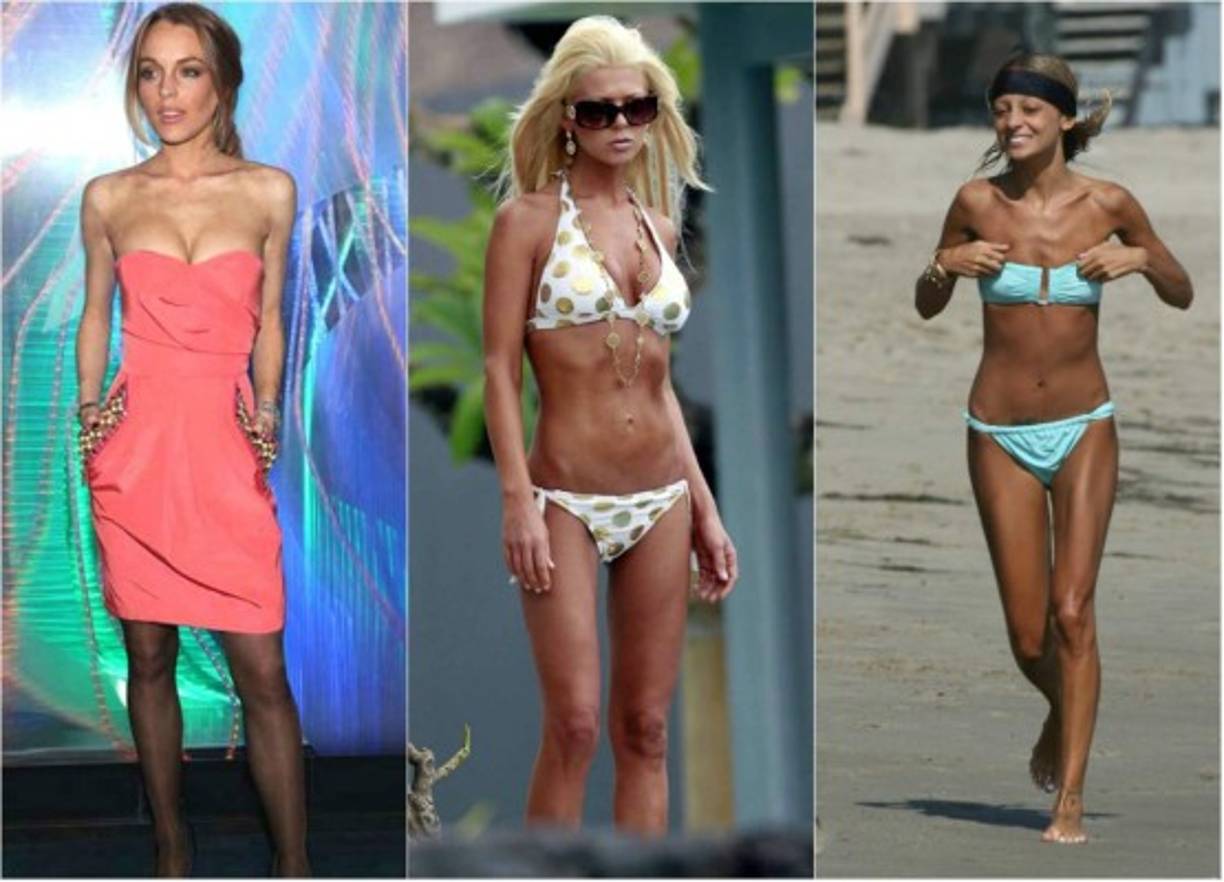 Varias famosas han confesado haber sufrido de algún tipo de desorden alimenticio en diferentes etapas de sus vidas profesionales debido a la exigencia del medio.