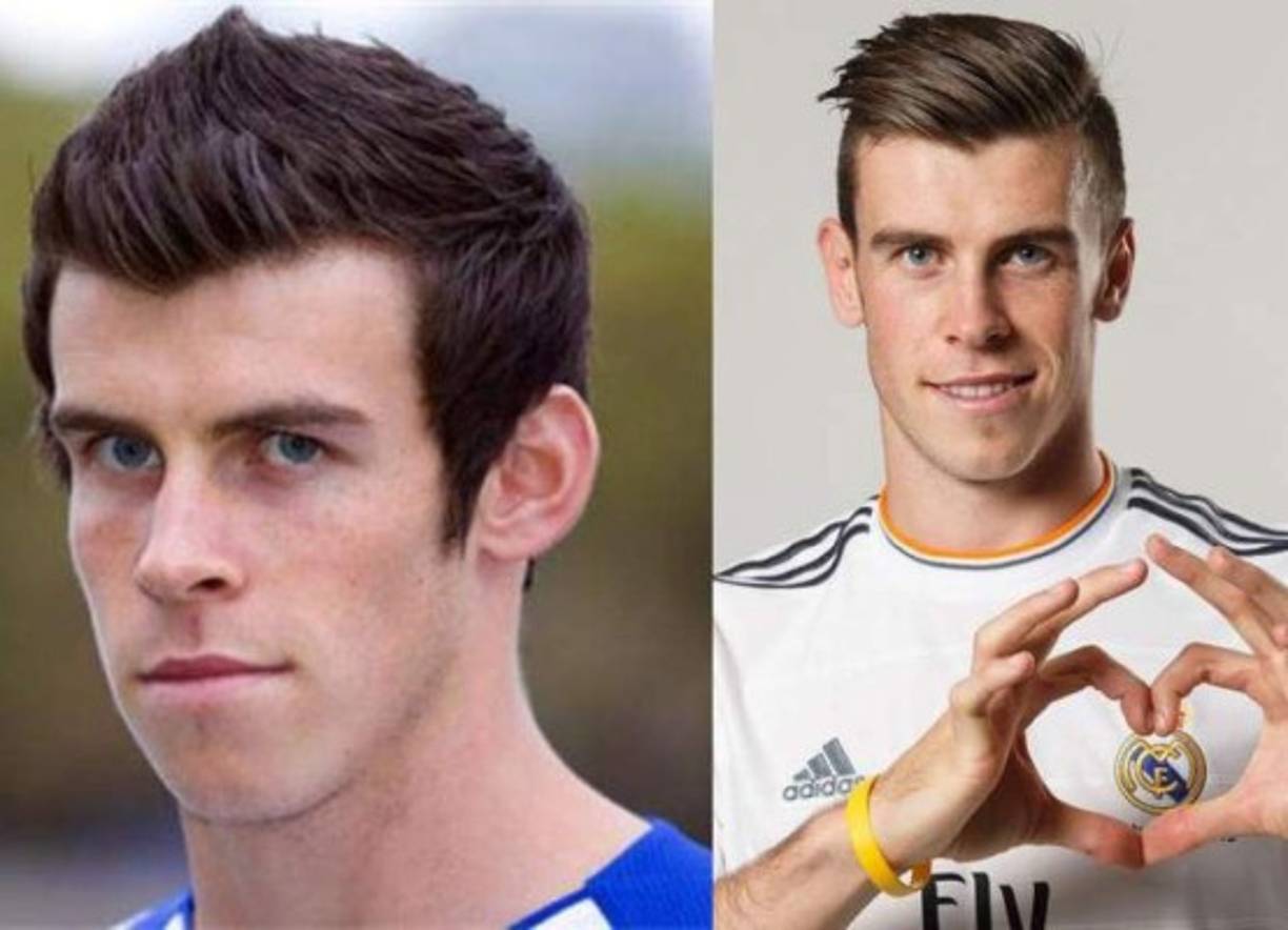 Gareth Bale: El delantero galés se operó sus orejas para poder reducir su tamaño, prestaba cansado que se burlaran de él desde niño.