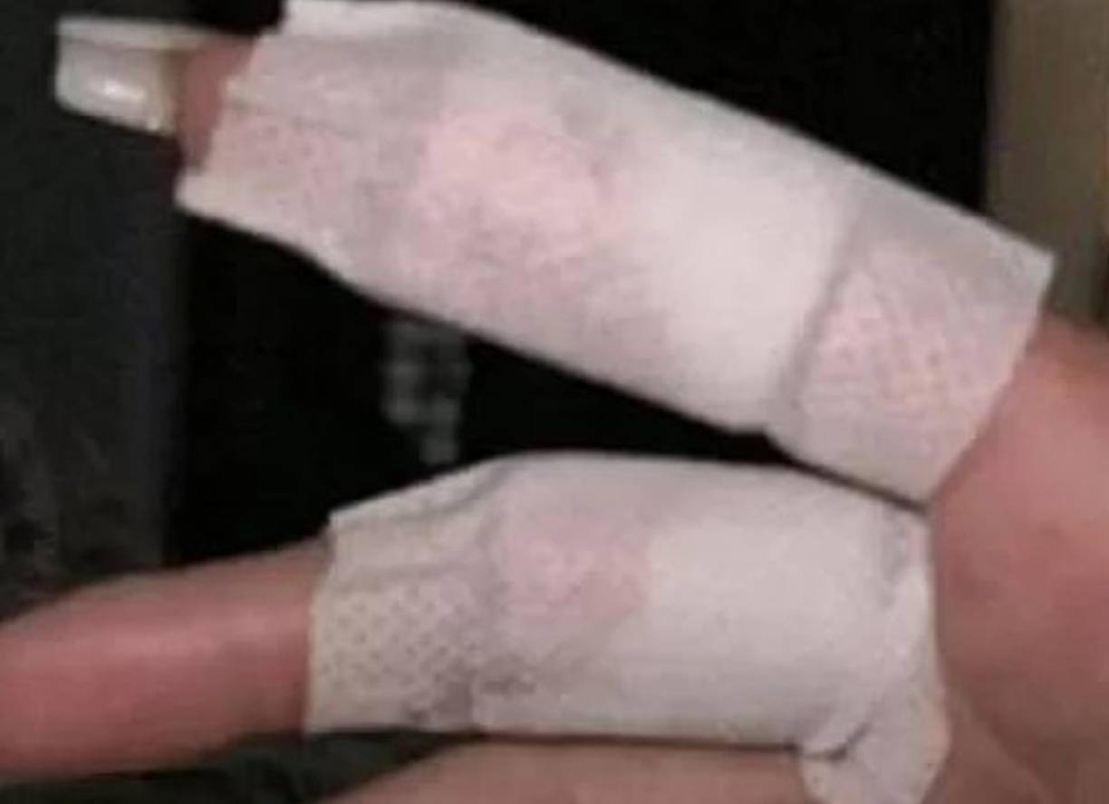 La joven mostró los golpes recibidos por parte de Antony.