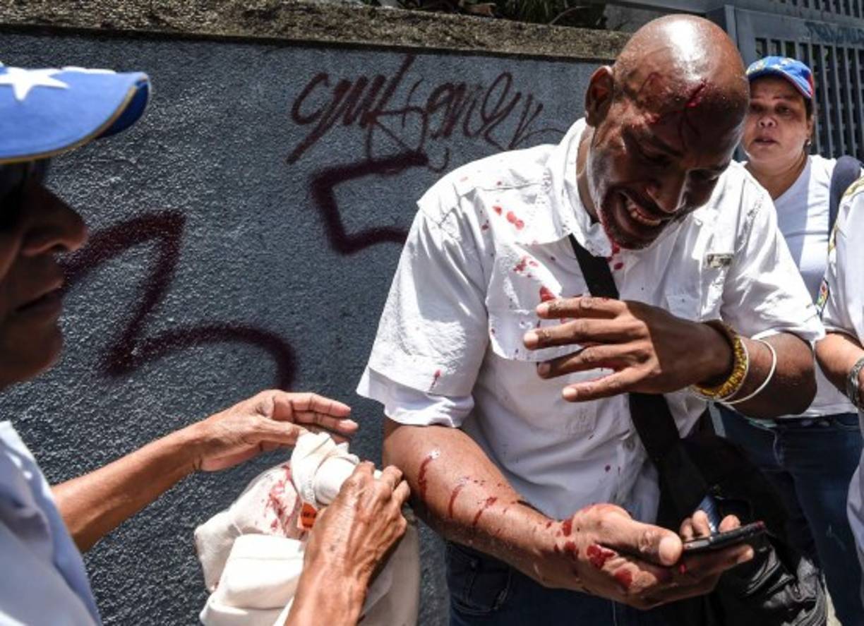 Los opositores quedaron bloqueados por las fuerzas de seguridad, y la concentración fue disuelta con gases y perdigones de goma cuando estudiantes chocaron de forma violenta contra el cordón policial para intentar romperlo y continuar su paso.