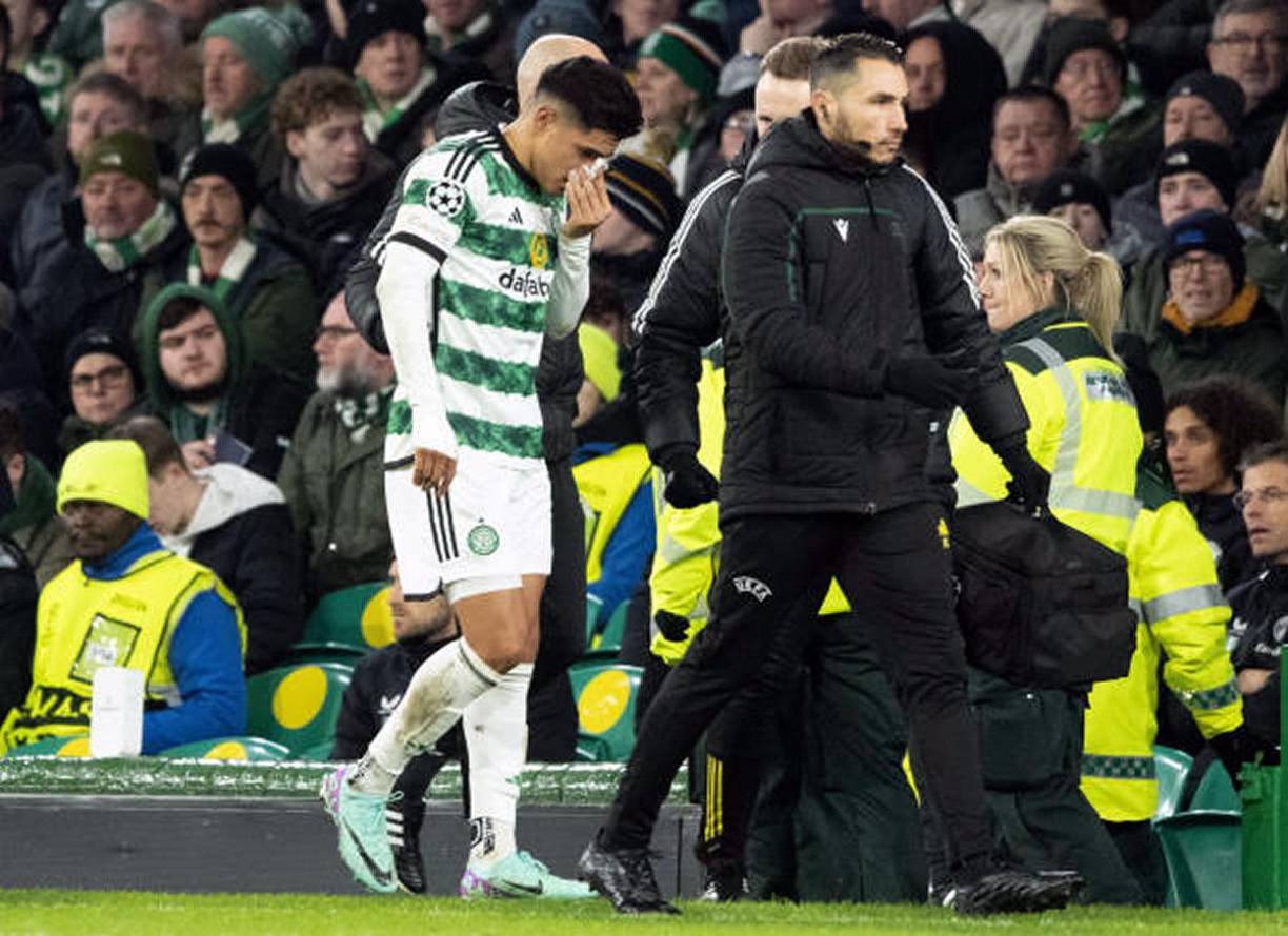 Luis Palma se fue del campo tapándose la nariz debido a que sangró tras el codazo que recibió.