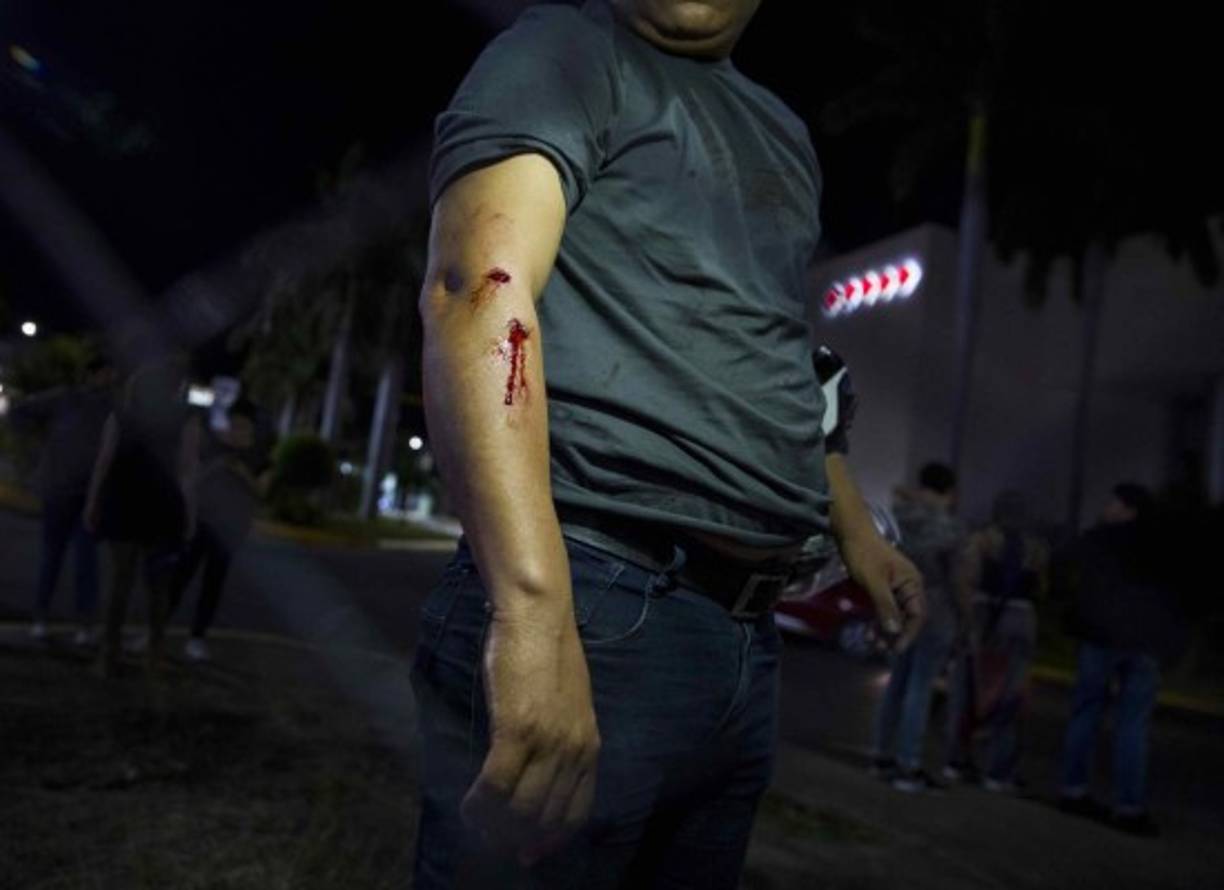 Los jóvenes lanzaron piedras y palos contra la multitud hiriendo a varias personas.