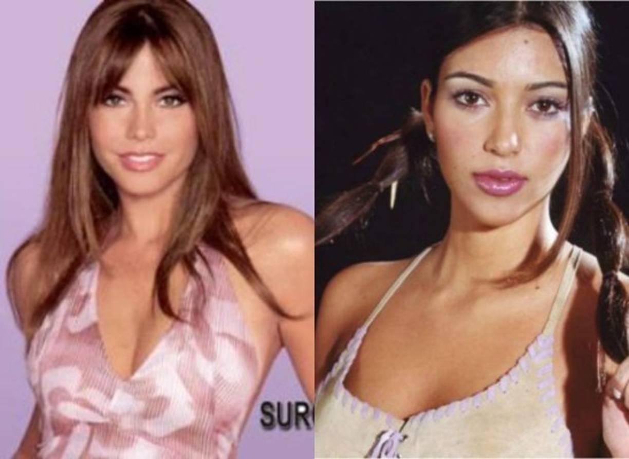 Son famosas, millonarias y muy sensuales... y también han pasado por el bisturí.